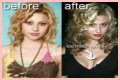 Aly Michalka Plastic Surgery Before and After