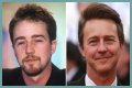 Edward Norton Plastic Surgery Before and After