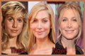 Elizabeth Mitchell Plastic Surgery Before and After