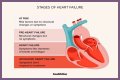 Heart Failure And The Plight Of Extreme Obesity
