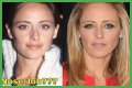 Kim Raver Plastic Surgery Before and After