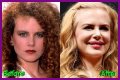 Nicole Kidman's "Lioness" Plastic Surgery: Uncovering Hidden Truths