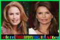 Roma Downey Plastic Surgery Before and After