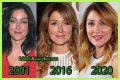 Sasha Alexander Plastic Surgery Before and After